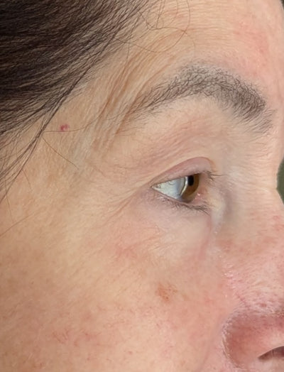 Close up shot of woman's eye area after using LED eye mask where improvements can be seen