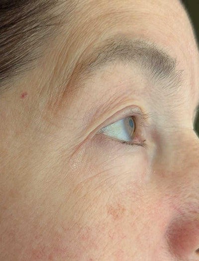 Close up shot of woman's eye area before using LED eye mask