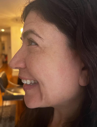 Side view after image of woman with lesser wrinkles around the eyes and jowls after 6 weeks of usage